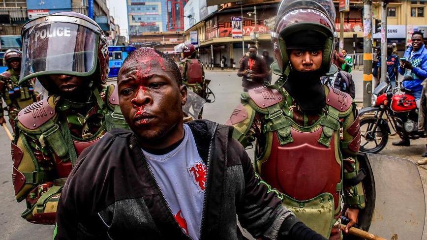 Police Officers Receive Compensation Over Protest-Related Injuries